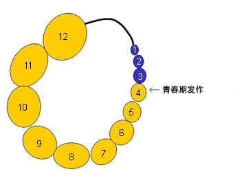 Prader 睾丸测量器