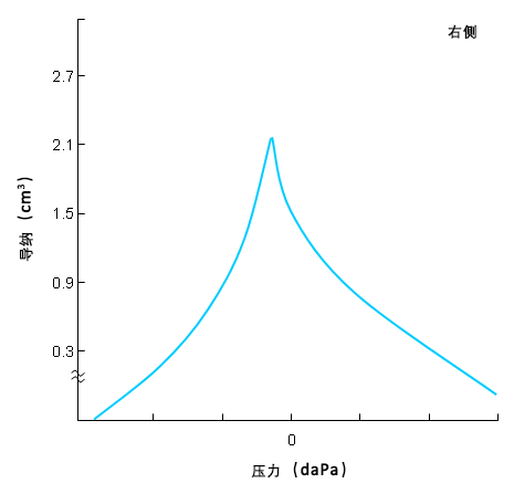 正常（A型）鼓室导抗图