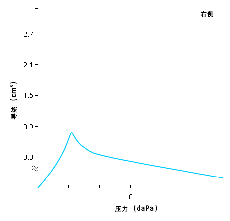 C 型鼓室导抗图，提示咽鼓管功能障碍